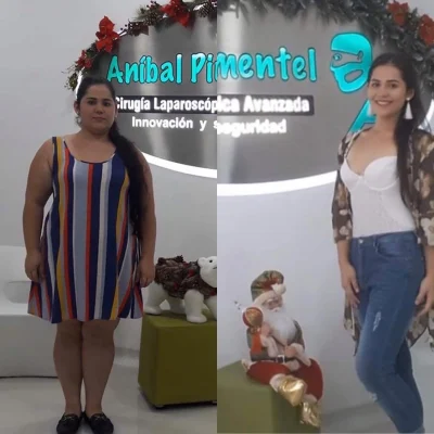 PRIMER-AÑO-POST-BYPASS-GASTRICO